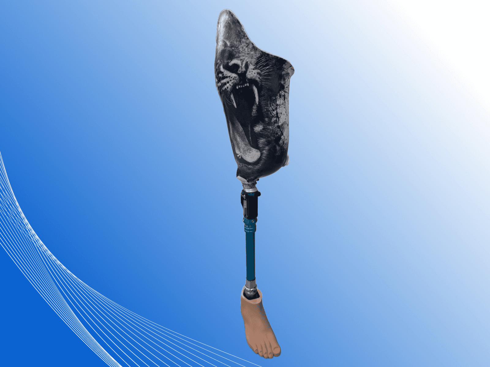 Протез бедра